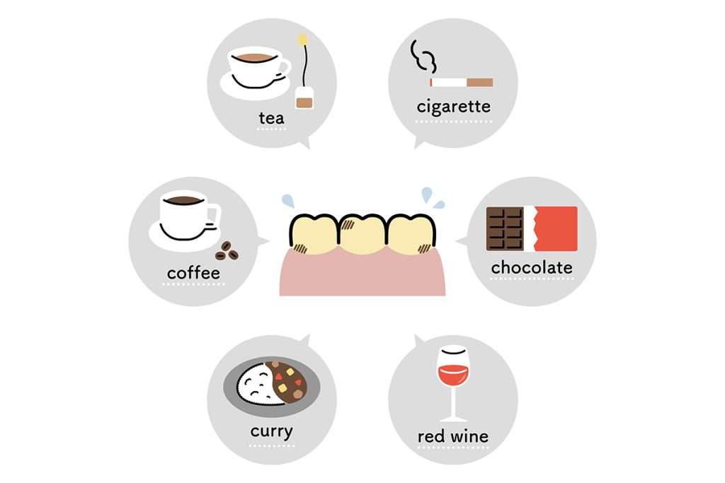 علاج تصبغ الاسنان