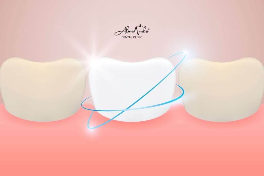الممنوعات بعد تبييض الاسنان بالليزر