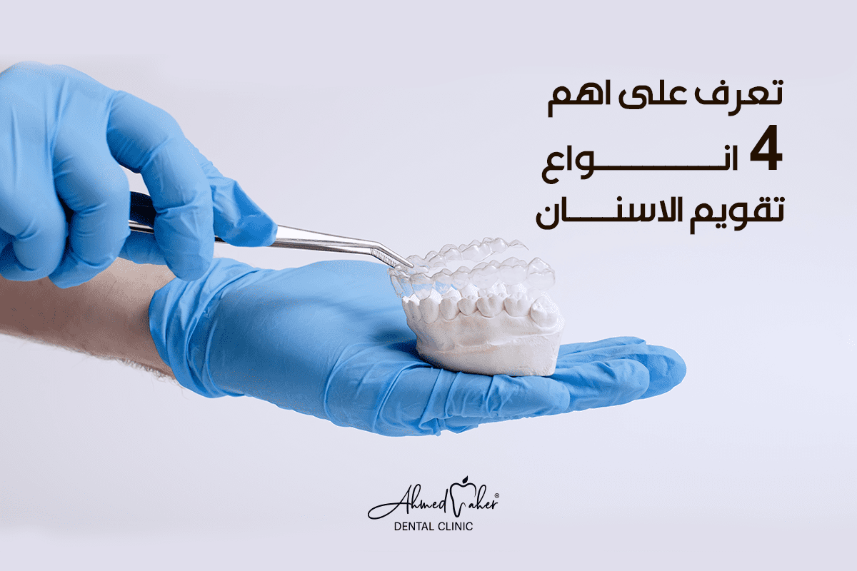 انواع تقويم الاسنان