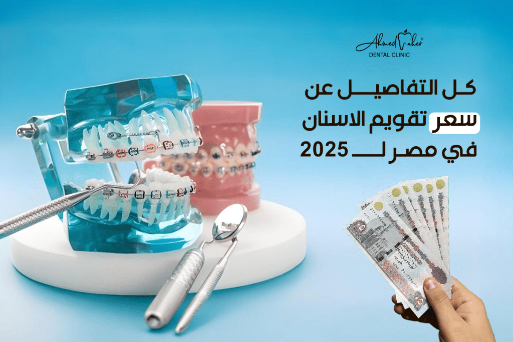 سعر تقويم الاسنان في مصر