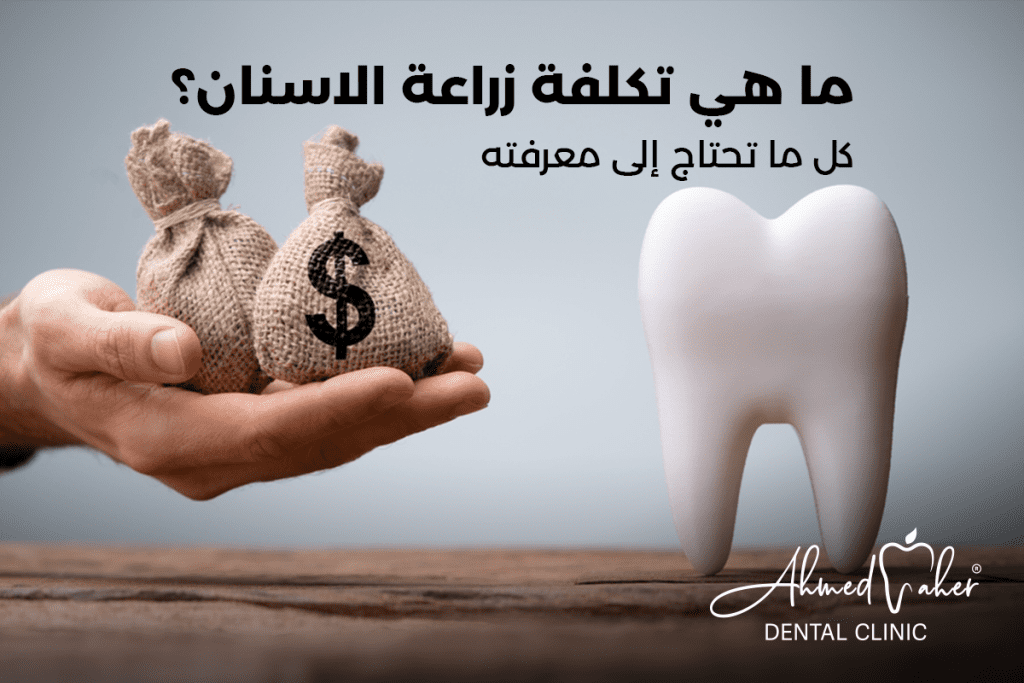 تكلفة زراعة الاسنان