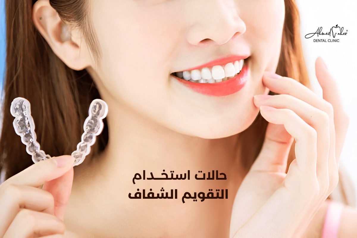 حالات استخدام التقويم الشفاف