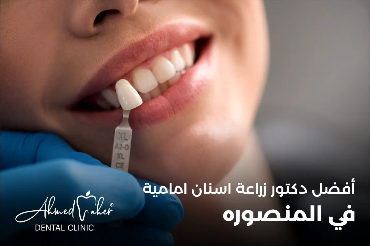 افضل دكتور زراعة اسنان امامية في المنصورة