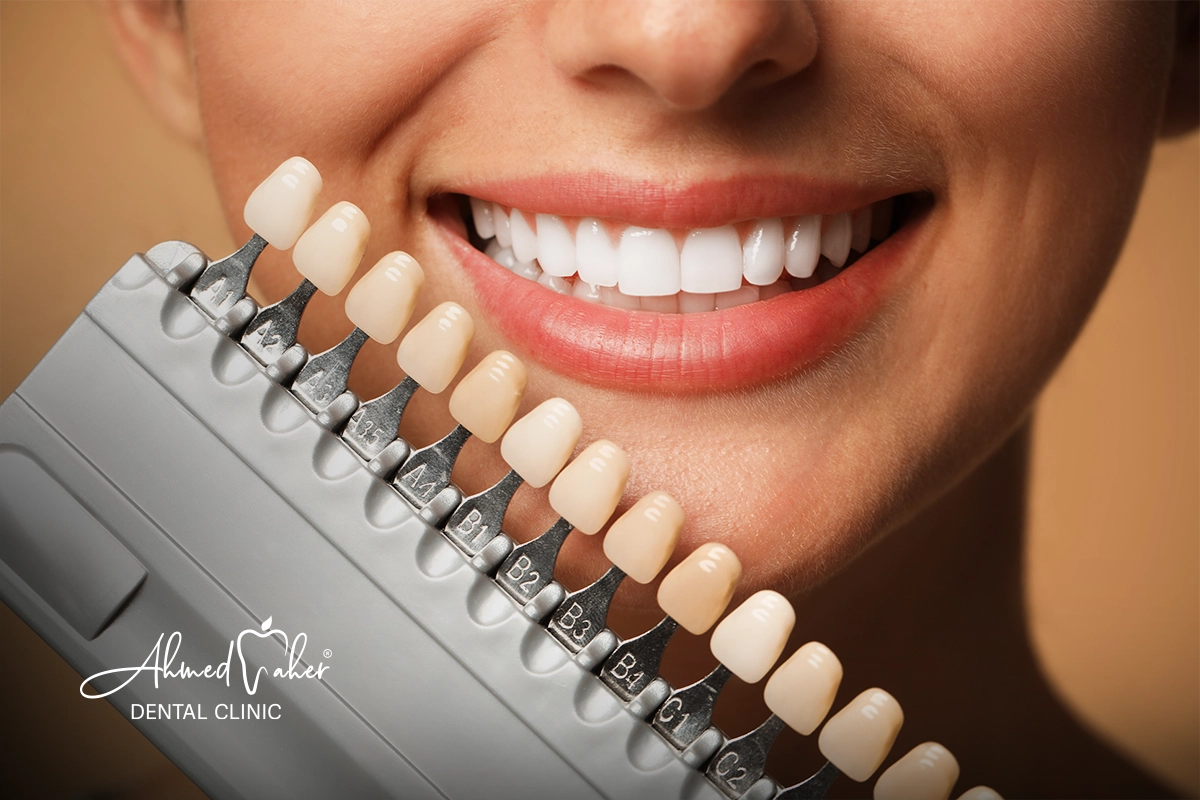 أشطر دكتور اسنان يقدم خدمة هوليود سمايل في المنصورة الدقهليه