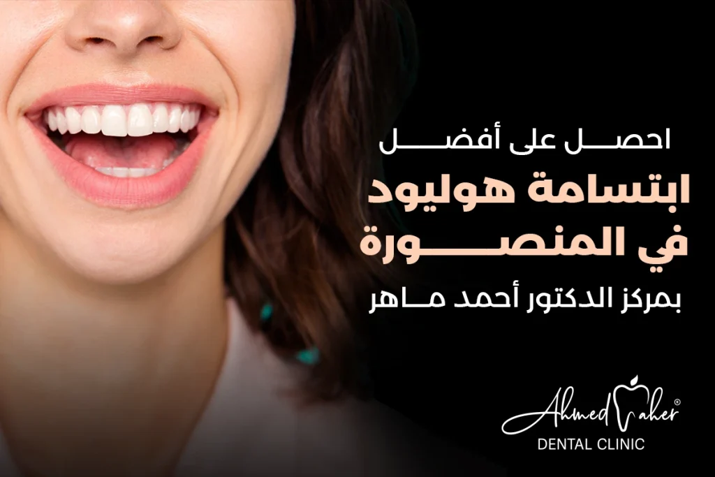 افضل ابتسامة هوليود في المنصورة بمركز الدكتور أحمد ماهر