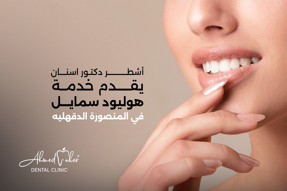 دكتور اسنان يقدم خدمة هوليود سمايل في المنصورة الدقهليه