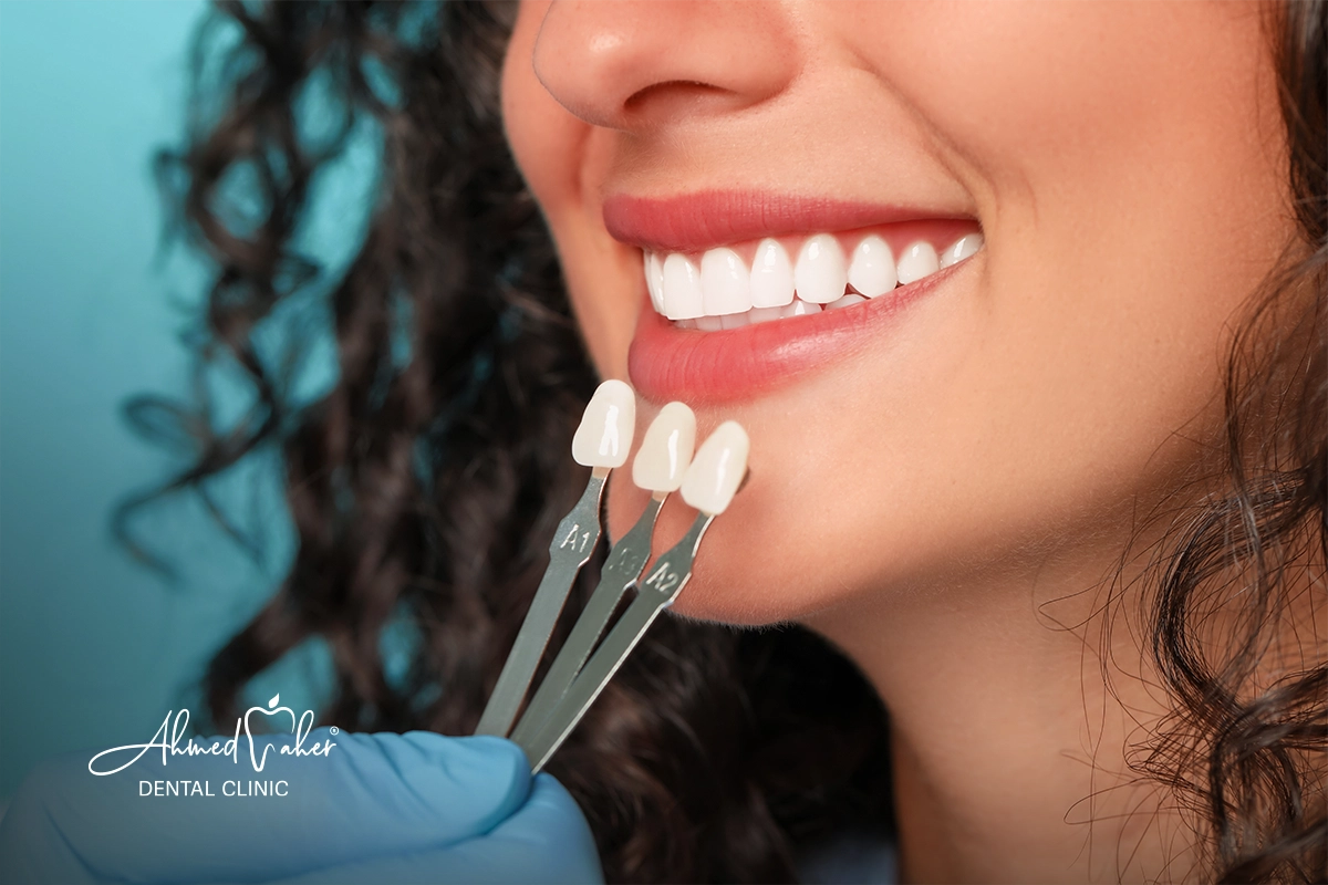 افضل دكتور فينير الأسنان في المنصورة الدقهلية 