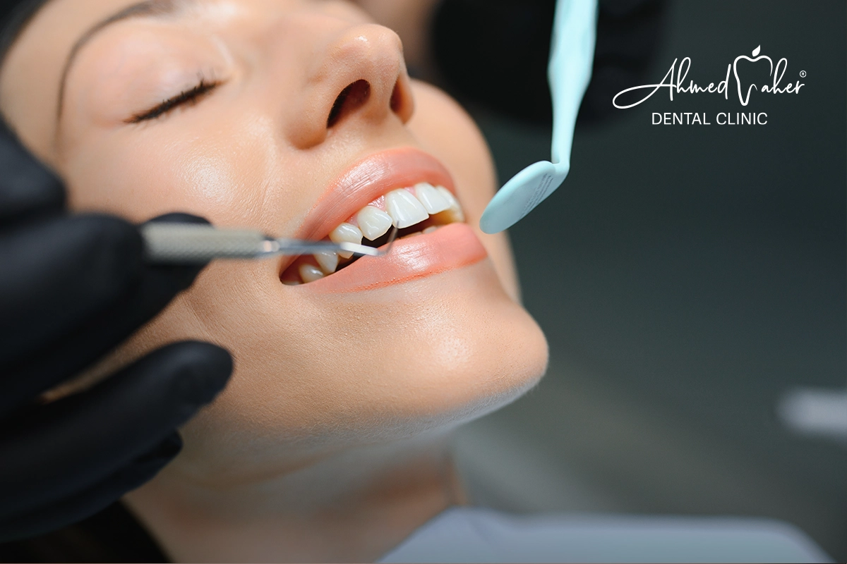 الفرق بين ابتسامة هوليود vip و 3D 