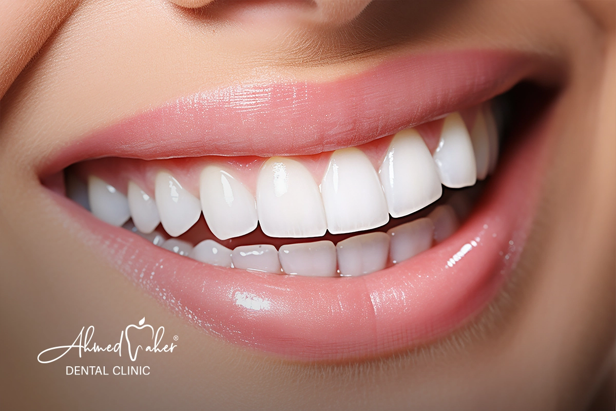 الفرق بين ابتسامة هوليود vip و 3D 