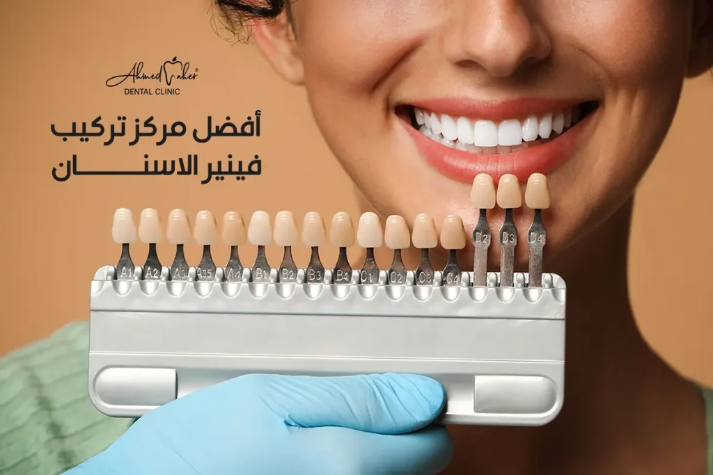 أفضل مركز تركيب فينير الاسنان في المنصورة