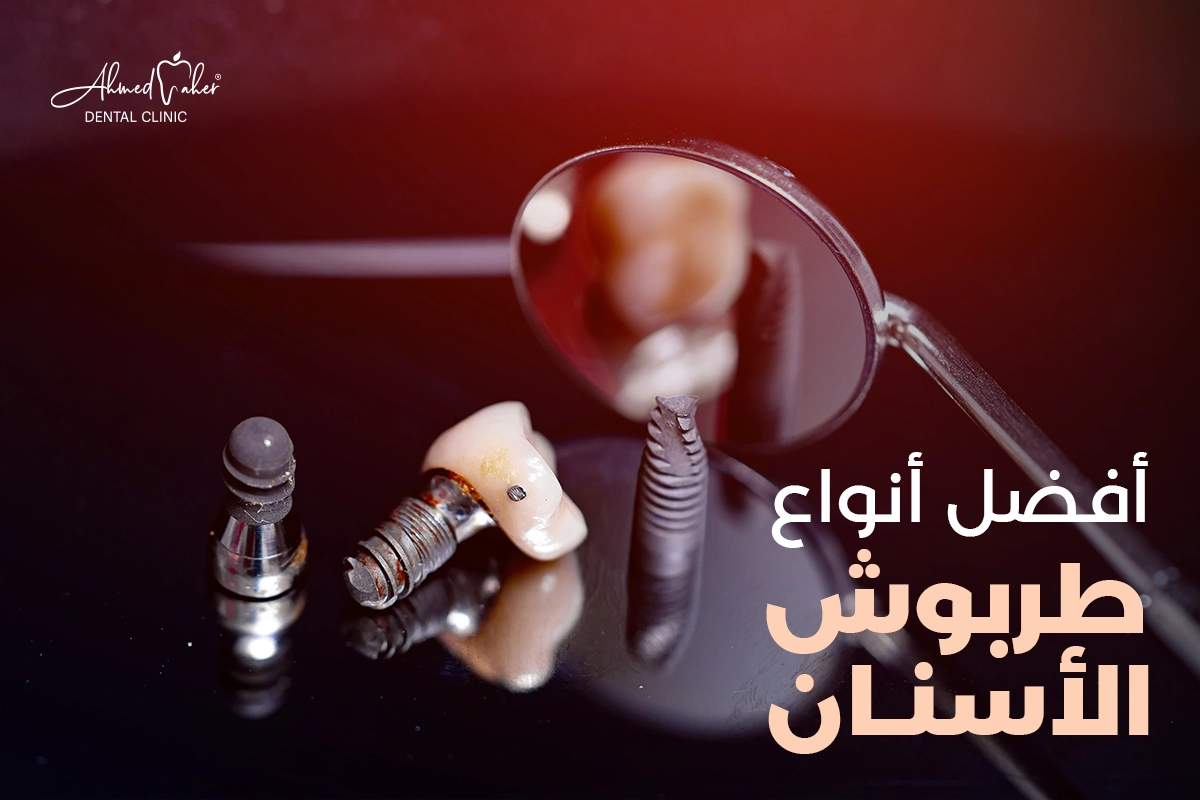 أفضل أنواع طربوش الأسنان : احجز الان مع مركز الدكتور أحمد ماهر