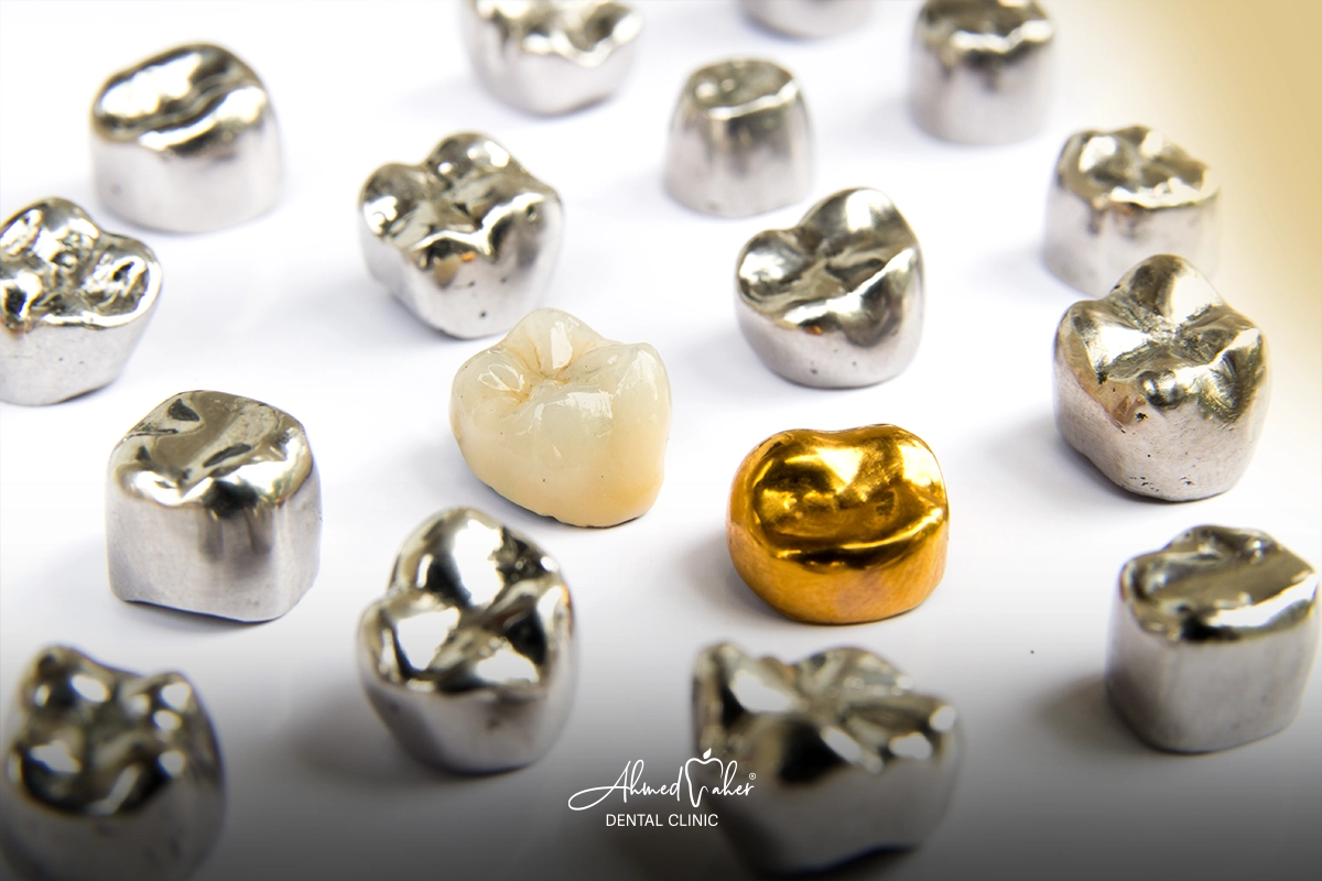 أفضل أنواع طربوش الأسنان