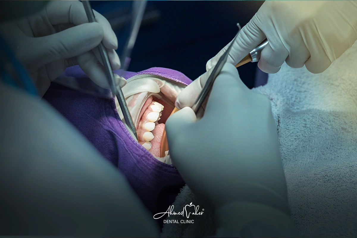 اشطر دكتور اسنان في المنصورة 