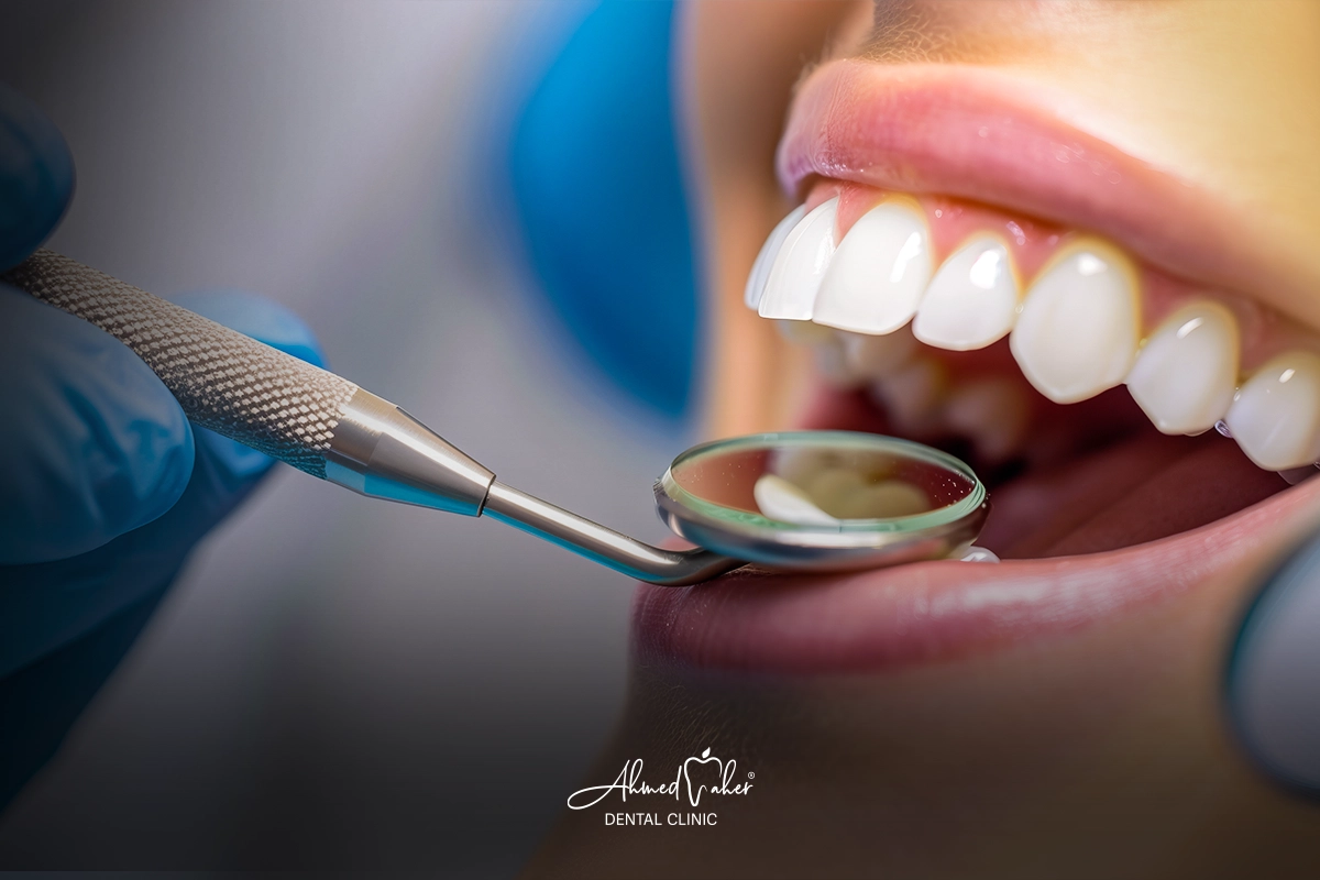 اشطر دكتور اسنان في المنصورة