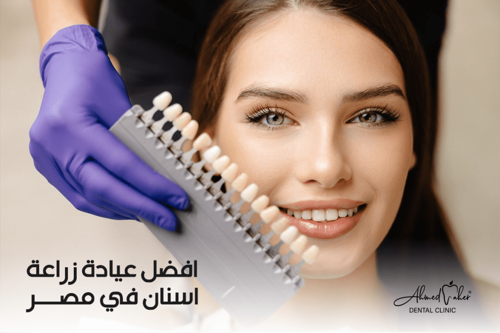 افضل عيادة زراعة اسنان في مصر