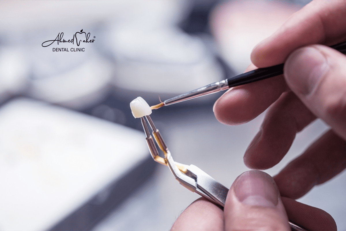 افضل عيادة زراعة اسنان في مصر