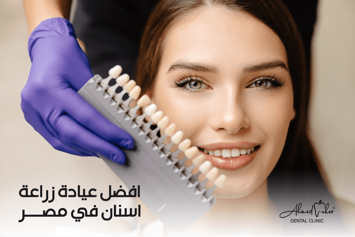 افضل عيادة زراعة اسنان في مصر